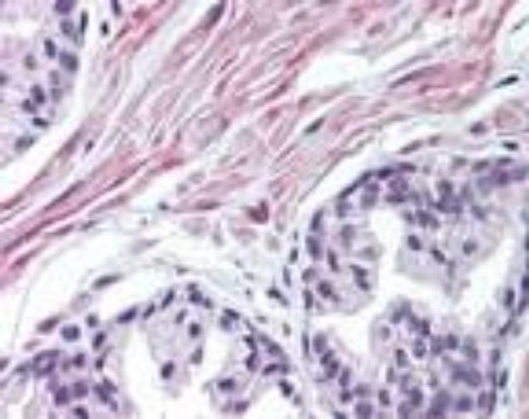 Immunohistochemistry-Paraffin: FNTA Antibody [NB100-56500] - analysis of human prostate using FNTA antibody at 10 ug/ml.