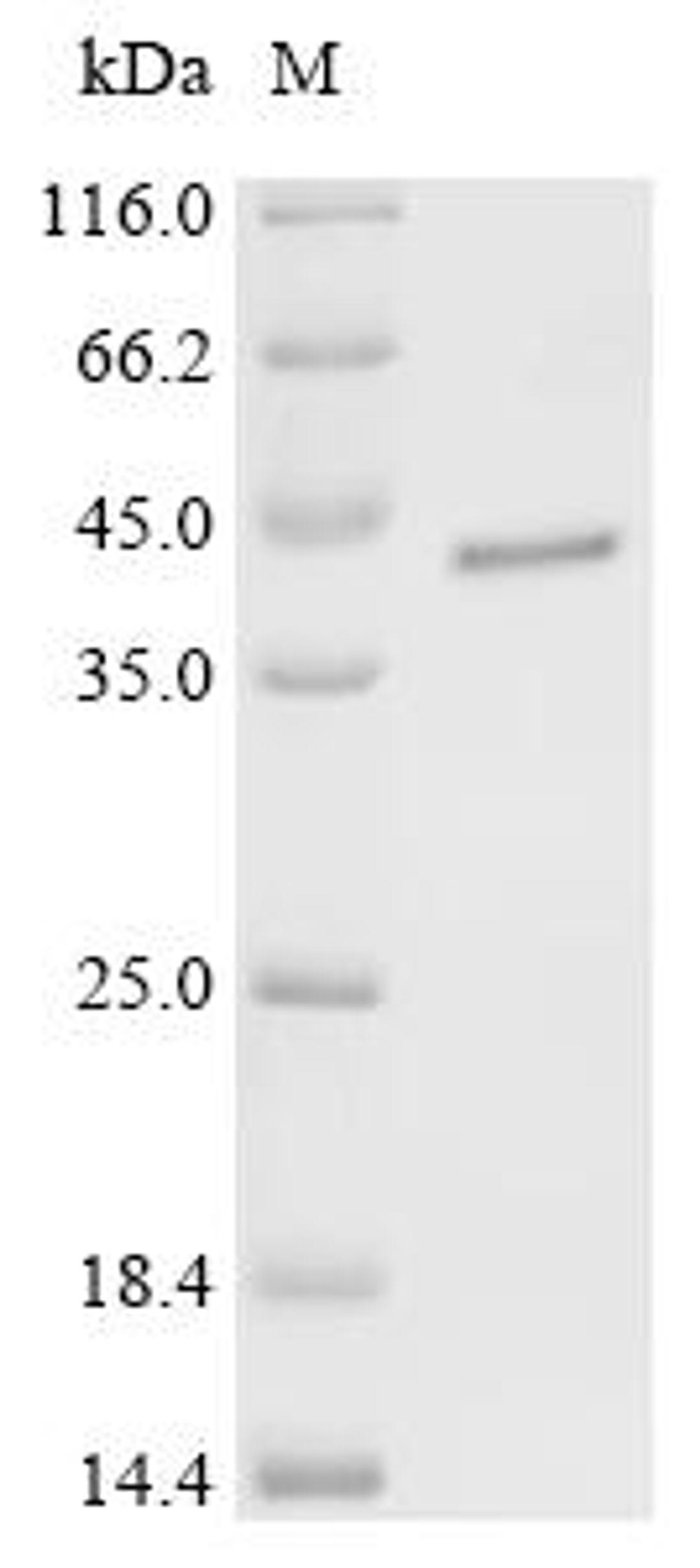 (Tris-Glycine gel) Discontinuous SDS-PAGE (reduced) with 5% enrichment gel and 15% separation gel.