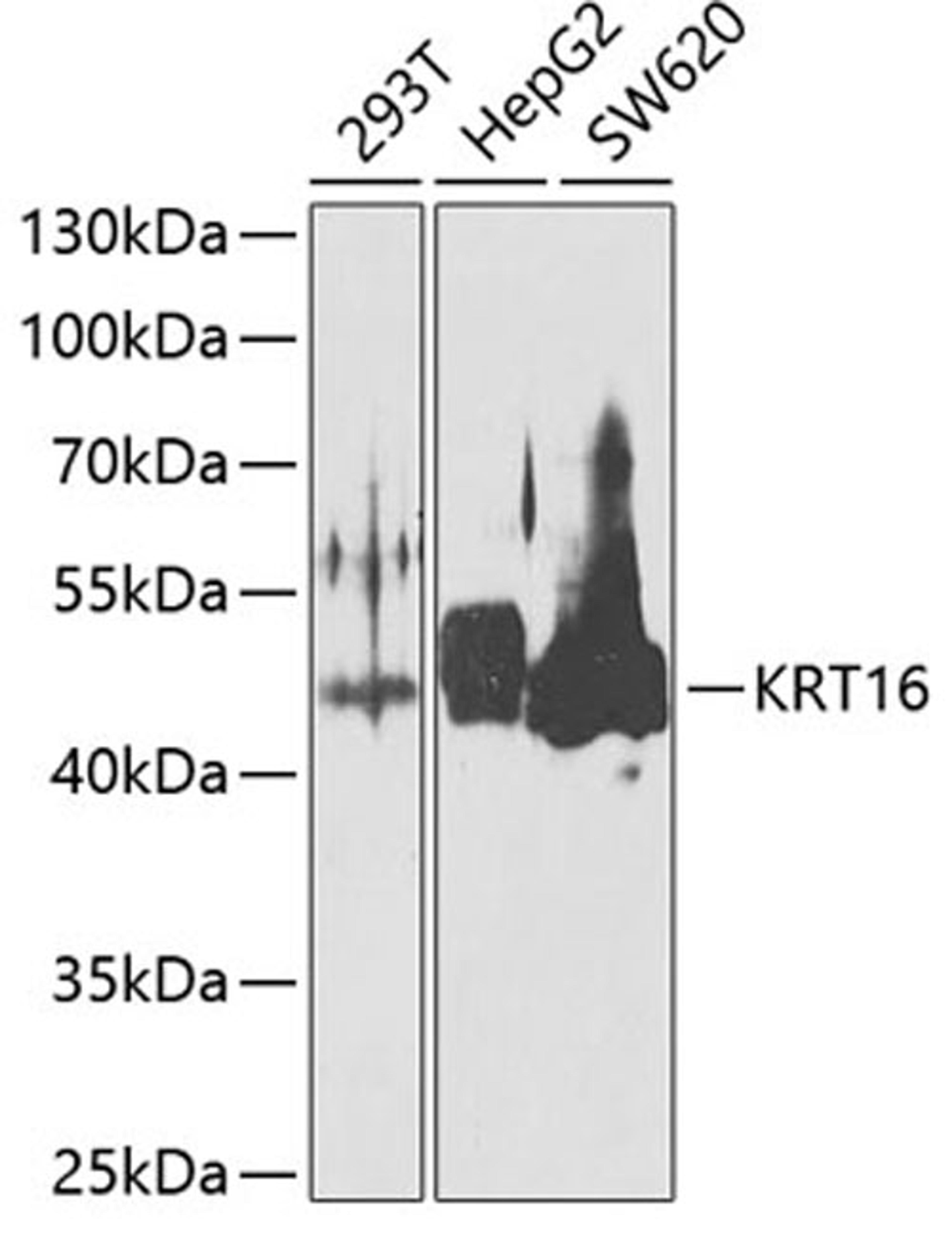 Western blot - KRT16 antibody (A7493)