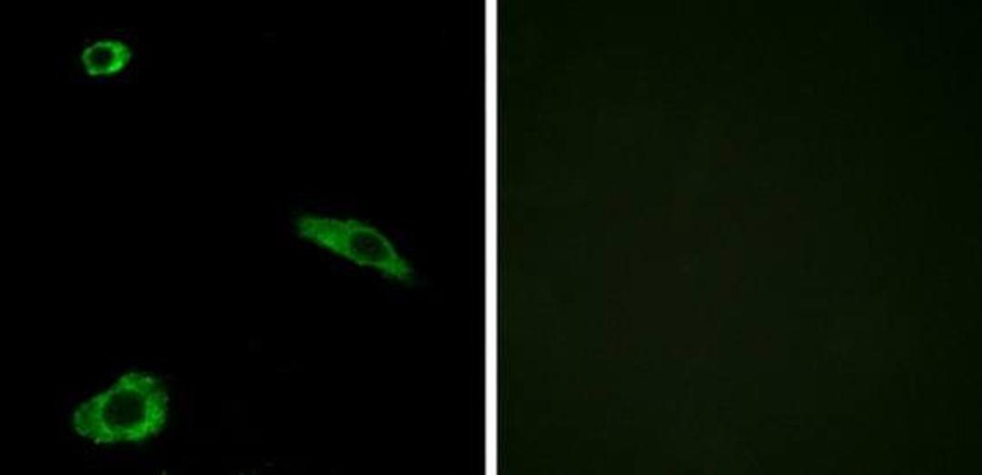 Immunofluorescence analysis of MCF-7 cells using ACTHR antibody.