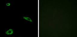 Immunofluorescence analysis of MCF-7 cells using ACTHR antibody.