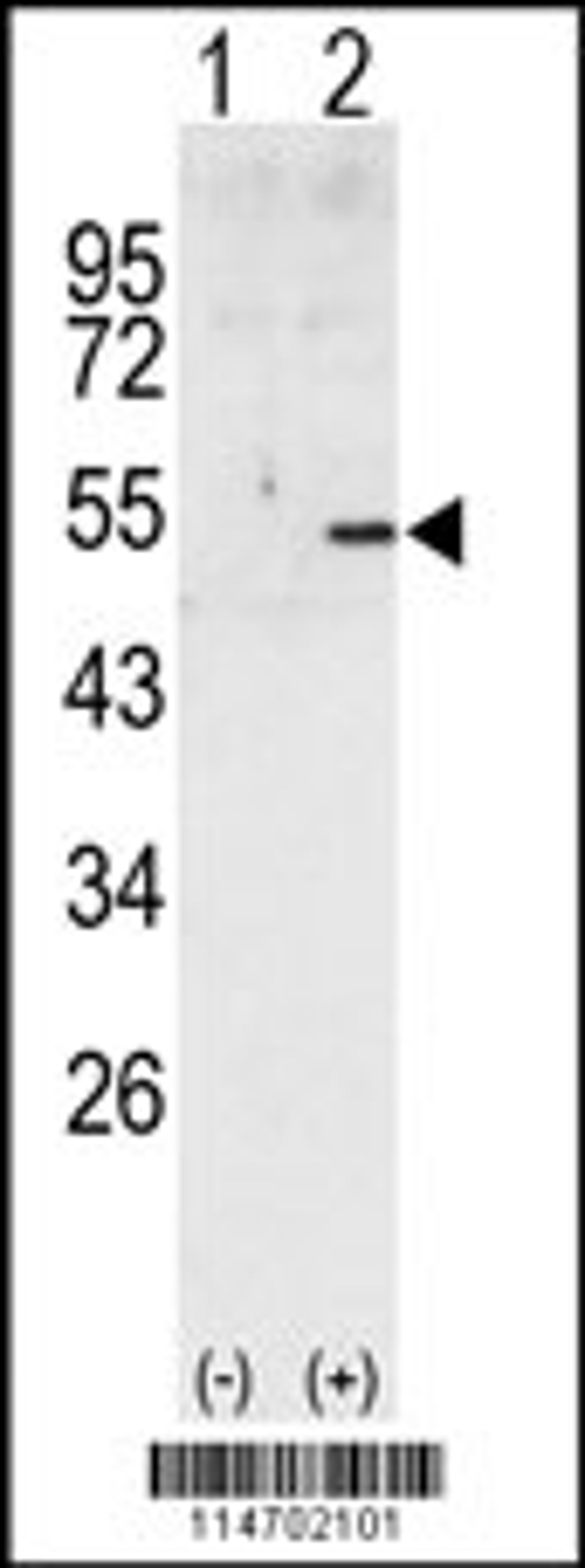 Western blot analysis of CCNA2 using rabbit polyclonal CCNA2 Antibody using 293 cell lysates (2 ug/lane) either nontransfected (Lane 1) or transiently transfected with the CCNA2 gene (Lane 2).