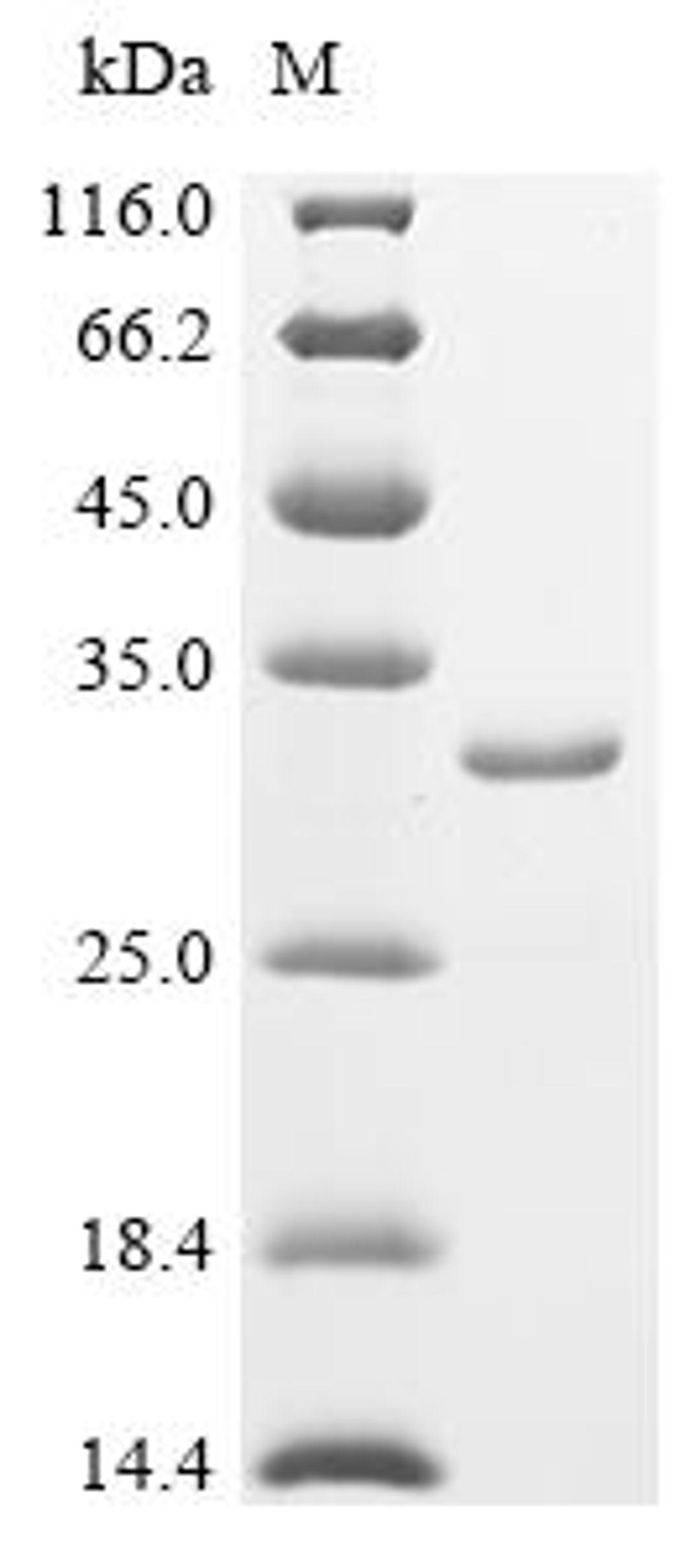 (Tris-Glycine gel) Discontinuous SDS-PAGE (reduced) with 5% enrichment gel and 15% separation gel.