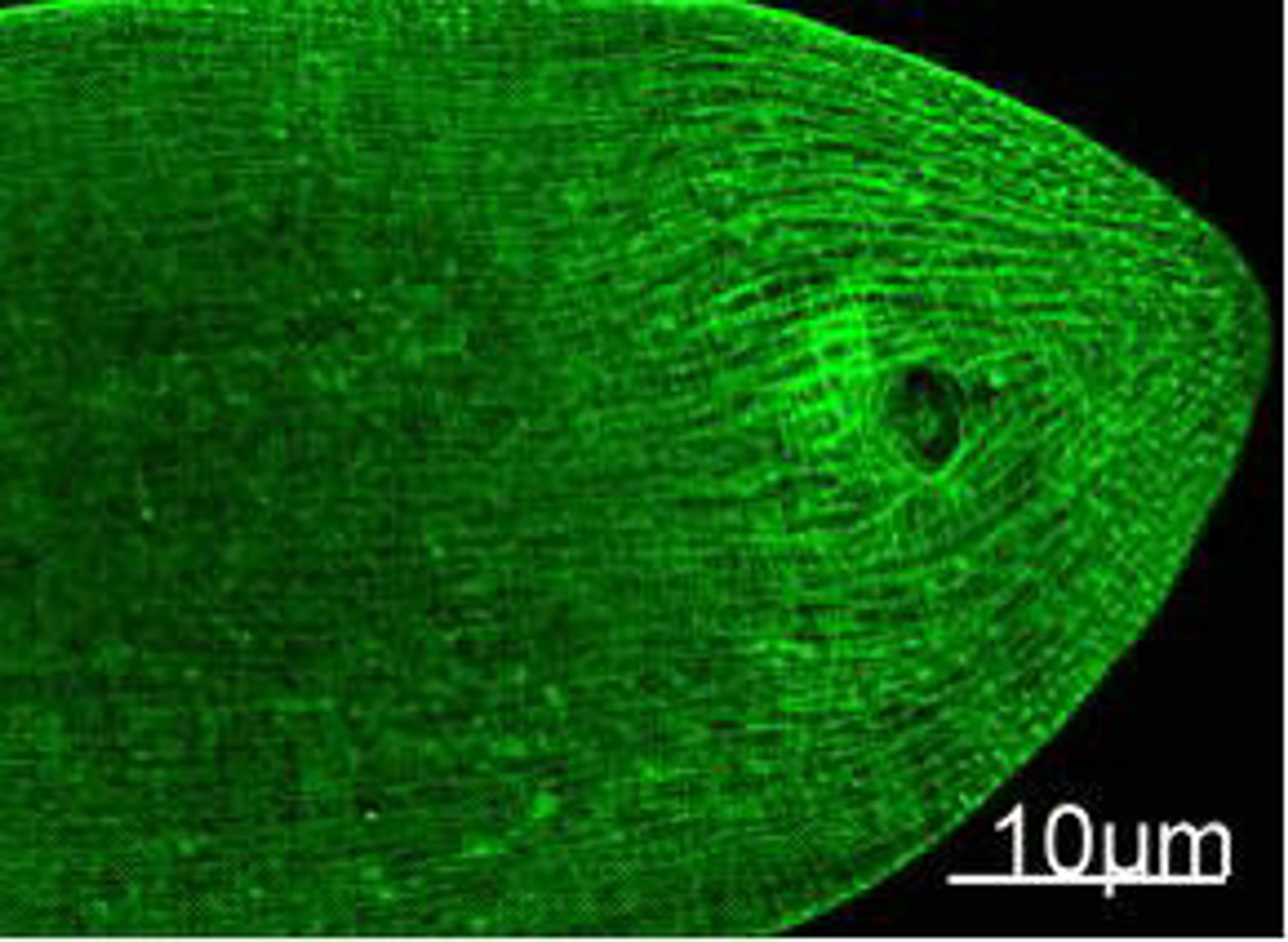 Immunofluorescence Staining of nematode tissue with MYH mouse mAb (11C2) diluted at 1:100. (Provide by Tsinghua University) .