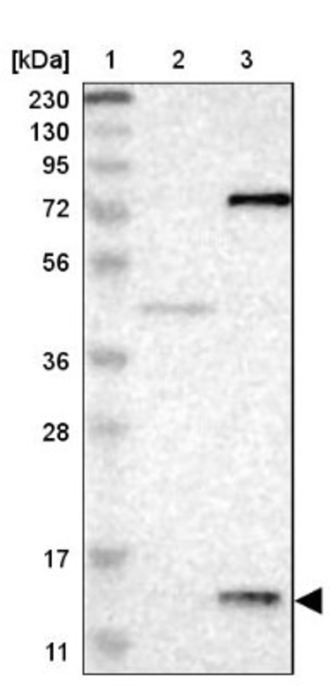 Western Blot: PFDN1 Antibody [NBP1-87294] - Lane 1: Marker [kDa] 230, 130, 95, 72, 56, 36, 28, 17, 11<br/>Lane 2: Human cell line RT-4<br/>Lane 3: Human cell line U-251MG sp