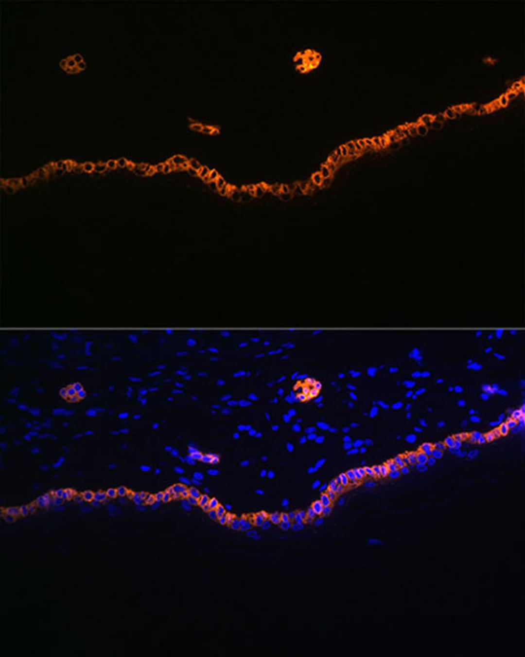 Immunofluorescence - Cytokeratin 15 Rabbit mAb (A4854)