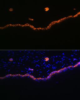 Immunofluorescence - Cytokeratin 15 Rabbit mAb (A4854)