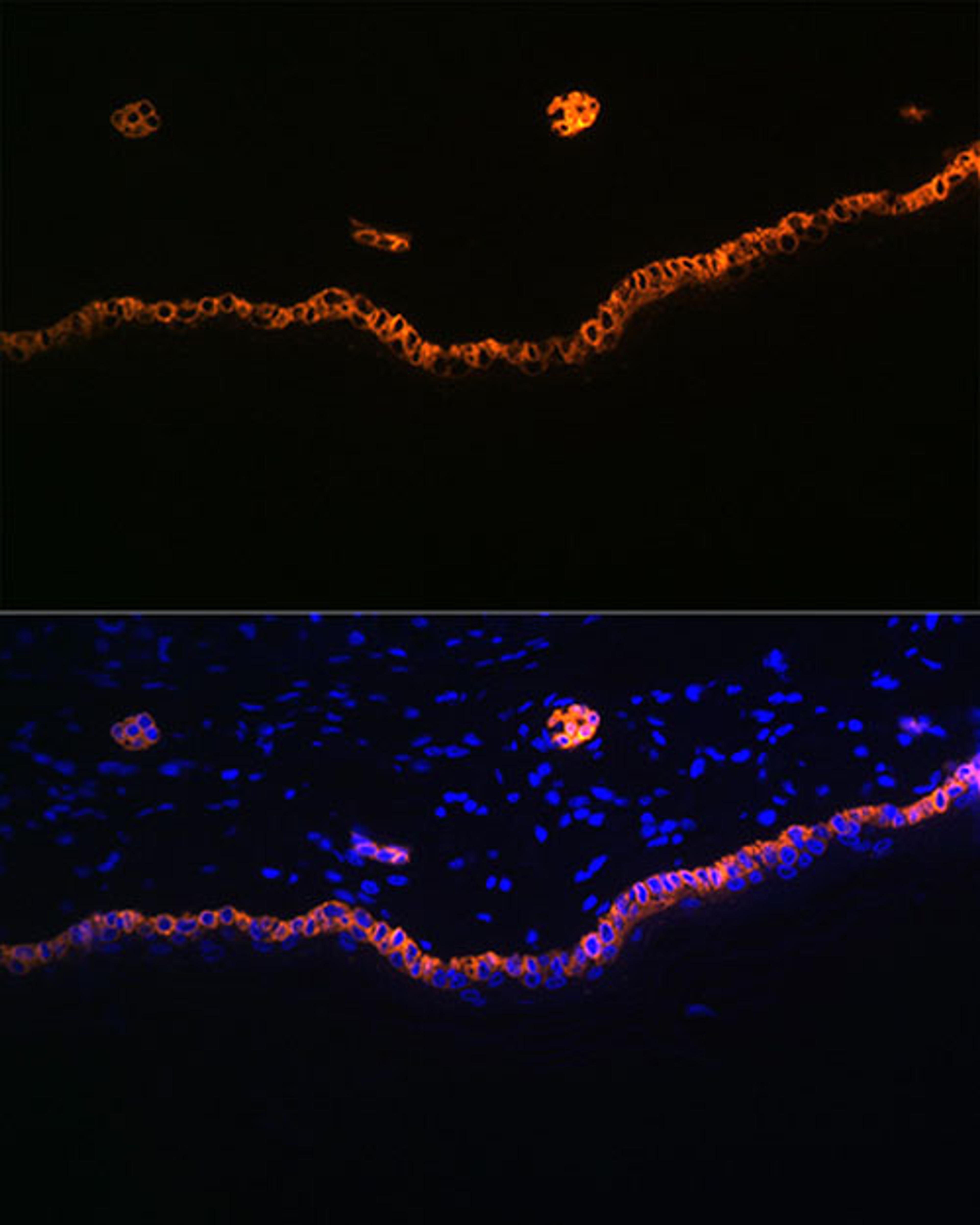 Immunofluorescence - Cytokeratin 15 Rabbit mAb (A4854)