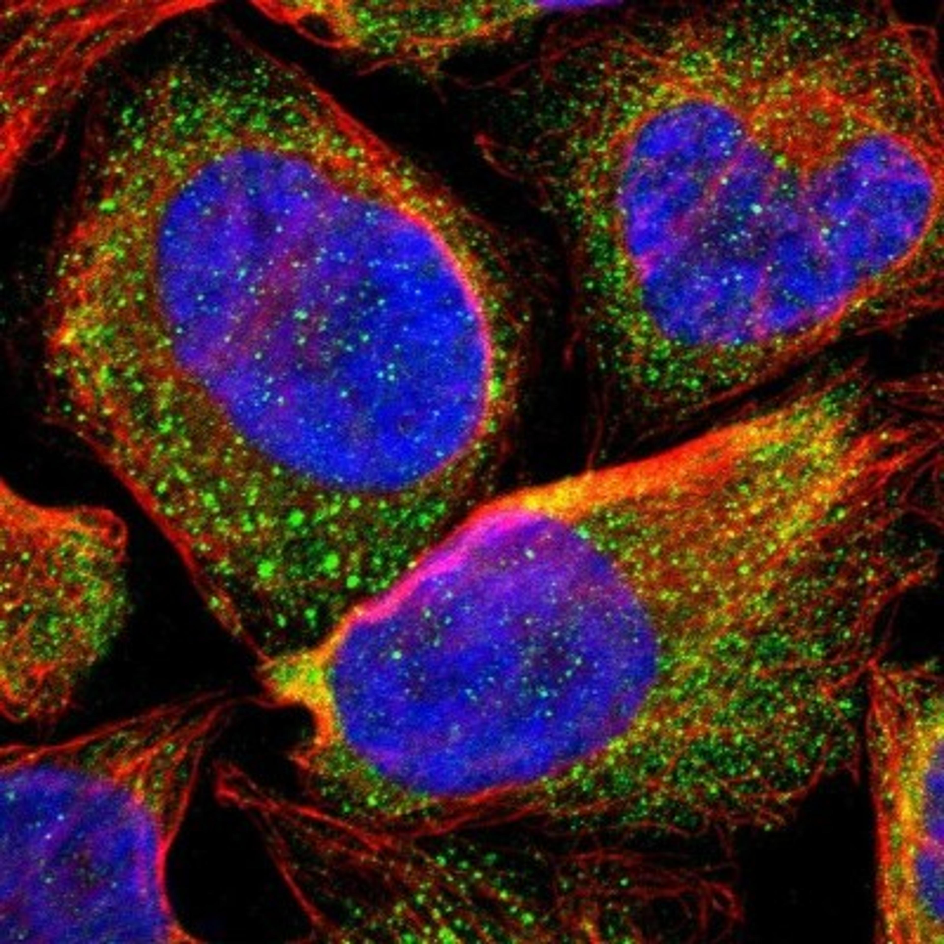 Immunocytochemistry/Immunofluorescence: ARSF Antibody [NBP1-86191] - Immunofluorescent staining of human cell line U-2 OS shows positivity in cytoplasm.