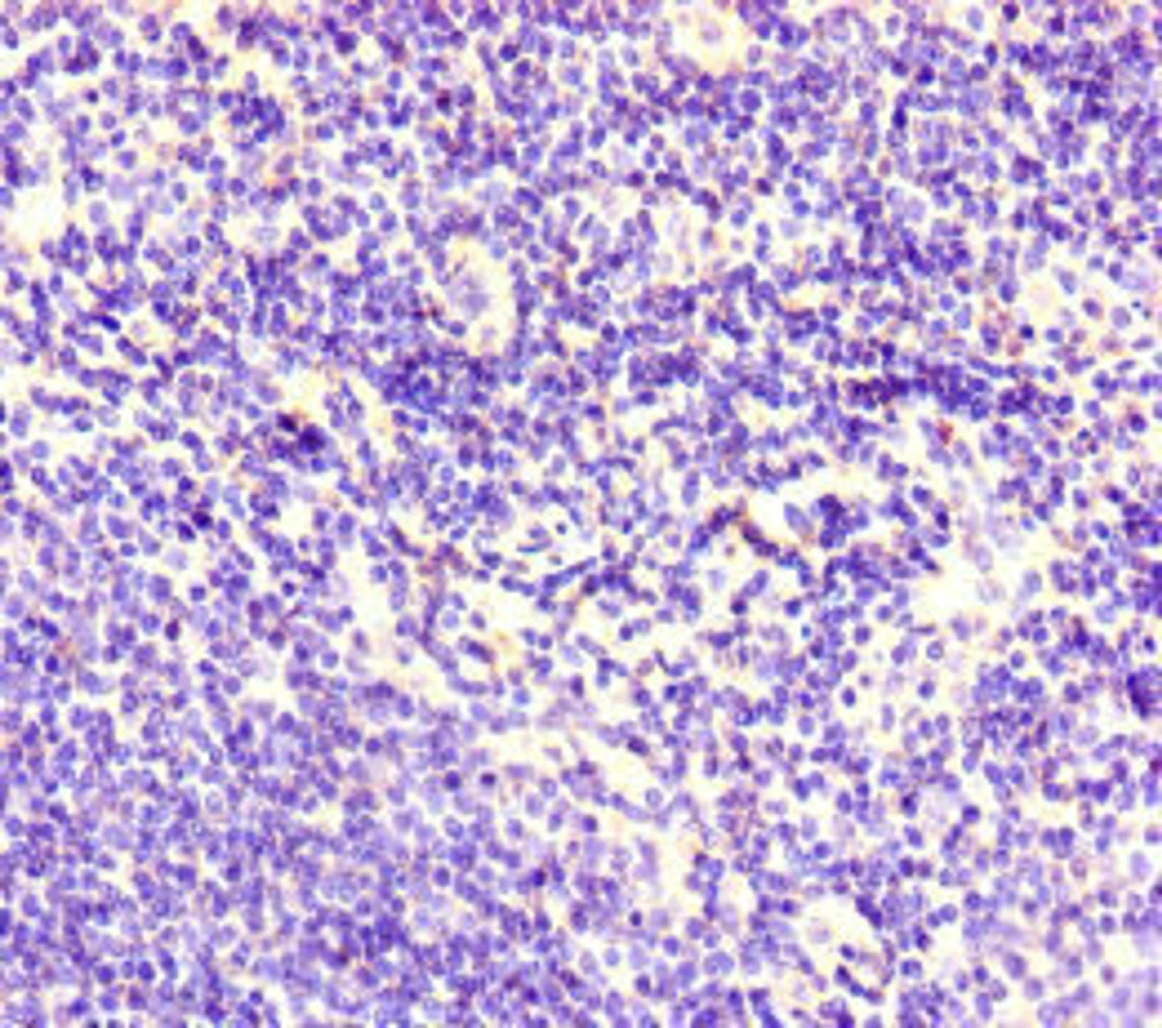Immunohistochemistry of paraffin-embedded human lymph node tissue using CSB-PA005124LA01HU at dilution of 1:100