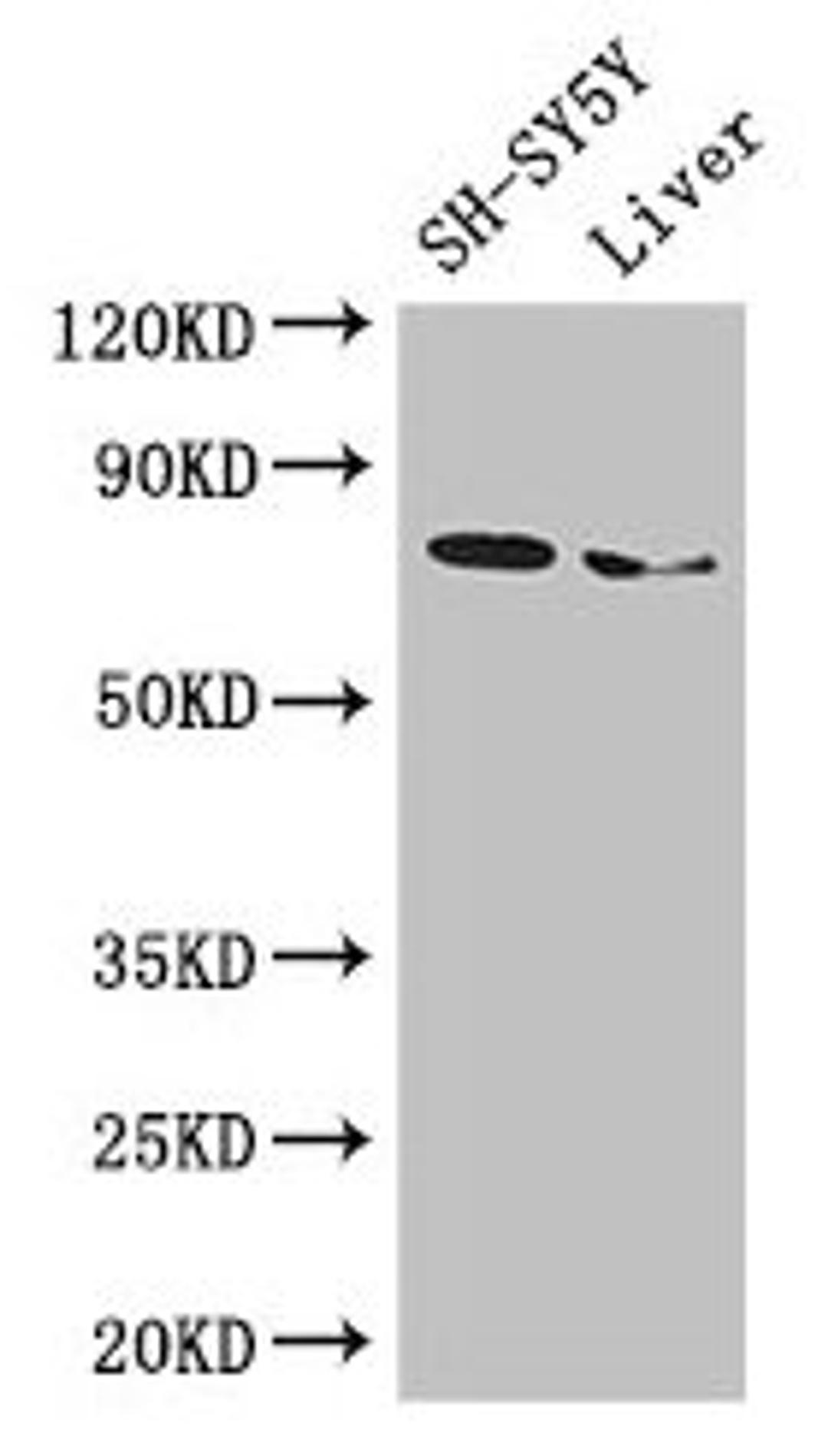 Western Blot. Positive WB detected in: SH-SY5Y whole cell lysate, Mouse liver tissue. All lanes: CHAT antibody at 3µg/ml. Secondary. Goat polyclonal to rabbit IgG at 1/50000 dilution. Predicted band size: 83, 75, 71 kDa. Observed band size: 75 kDa