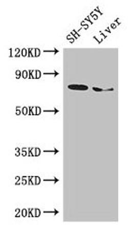 Western Blot. Positive WB detected in: SH-SY5Y whole cell lysate, Mouse liver tissue. All lanes: CHAT antibody at 3µg/ml. Secondary. Goat polyclonal to rabbit IgG at 1/50000 dilution. Predicted band size: 83, 75, 71 kDa. Observed band size: 75 kDa