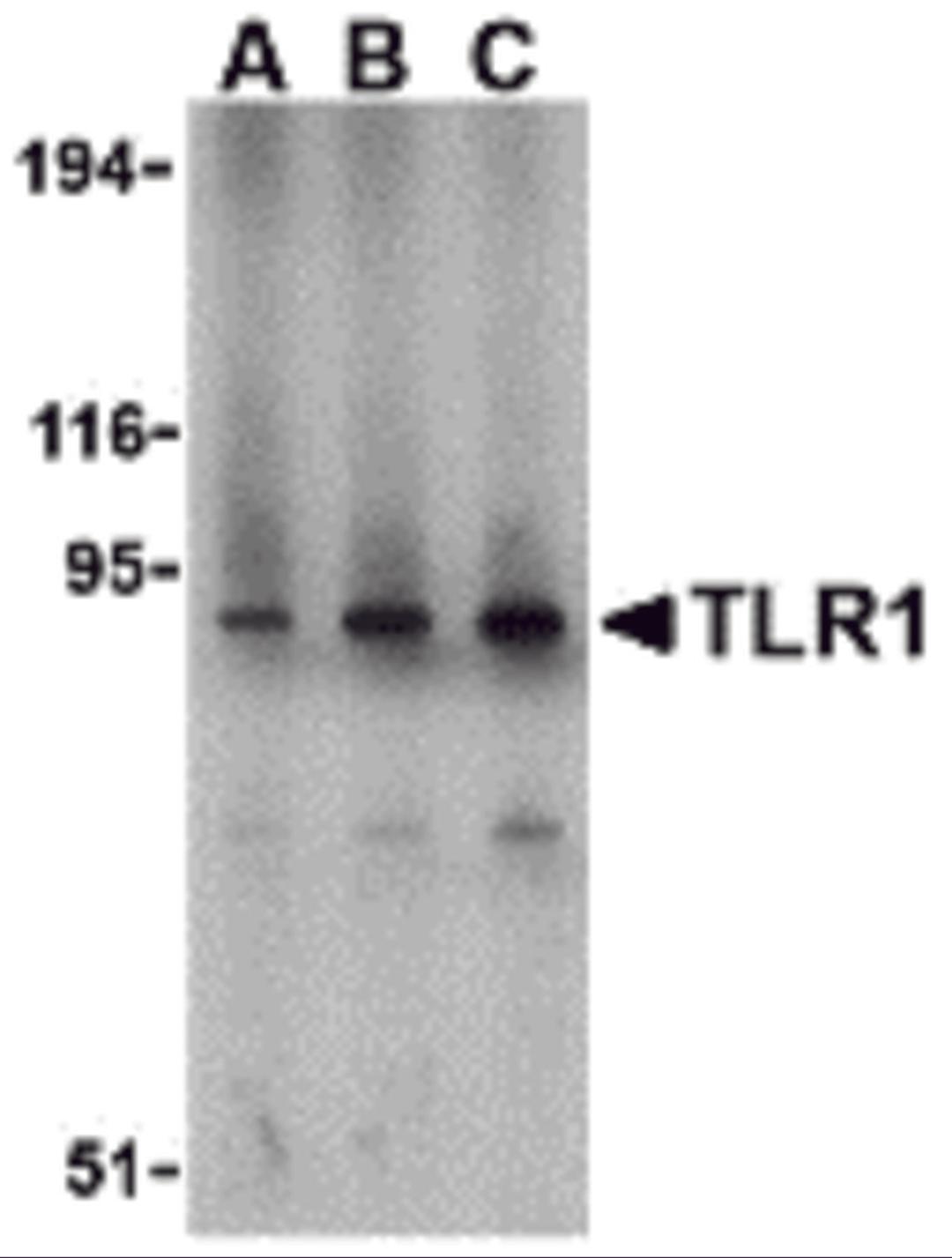 Western blot analysis of TLR1 in mouse spleen lysate with TLR1 antibody at (A) 1, (B) 2, and (C) 4 &#956;g/mL.