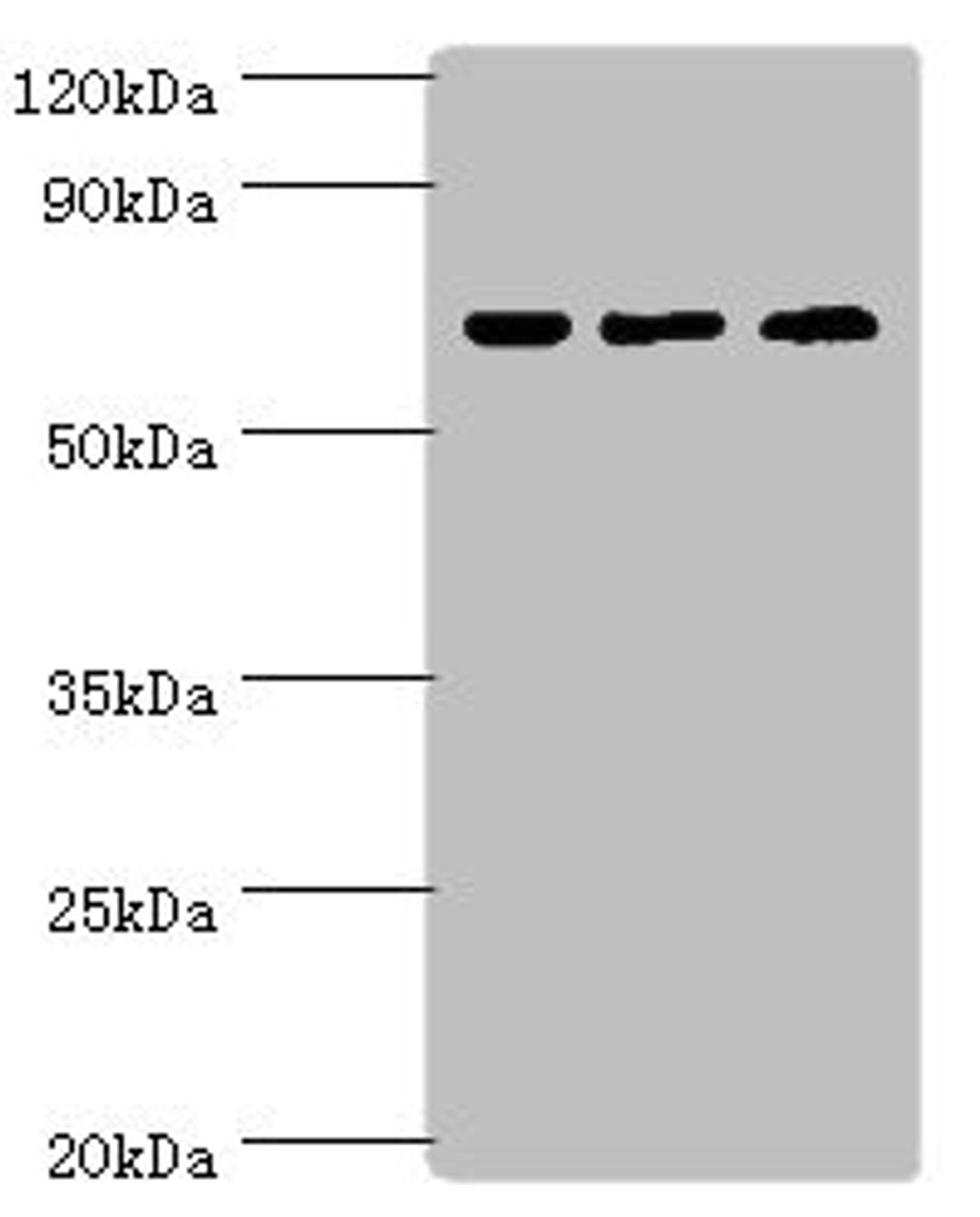 Western blot. All lanes: PIAS2 antibody at 2µg/ml. Lane 1: A431 whole cell lysate. Lane 2: HepG2 whole cell lysate. Lane 3: Mouse brain tissue. Secondary. Goat polyclonal to rabbit IgG at 1/10000 dilution. Predicted band size: 69, 64, 46 kDa. Observed band size: 69 kDa