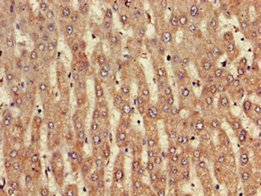 Immunohistochemistry of paraffin-embedded human liver tissue using CSB-PA856441LA01HU at dilution of 1:100