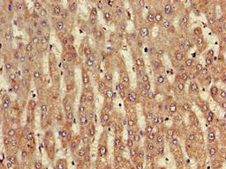 Immunohistochemistry of paraffin-embedded human liver tissue using CSB-PA856441LA01HU at dilution of 1:100
