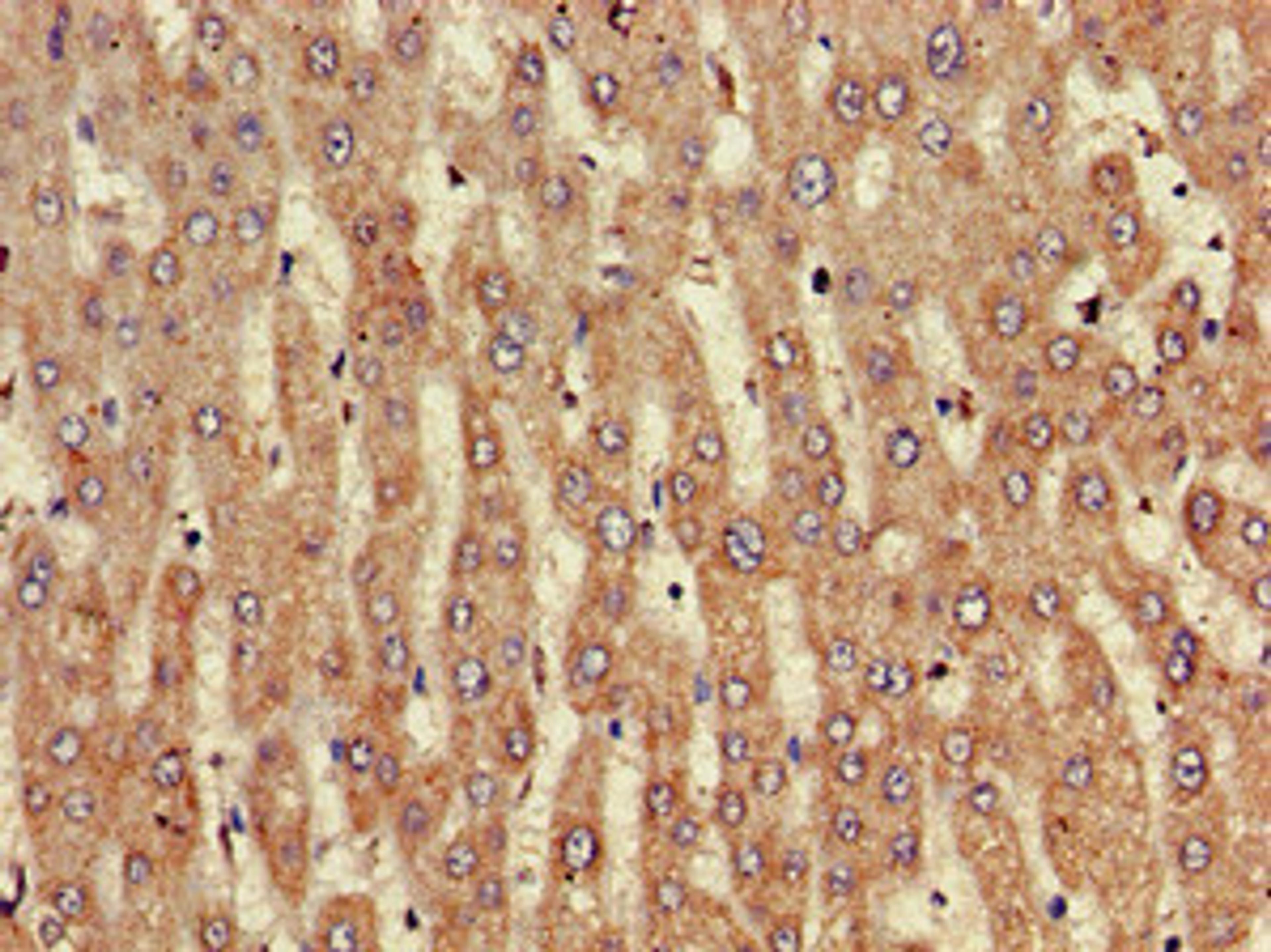 Immunohistochemistry of paraffin-embedded human liver tissue using CSB-PA856441LA01HU at dilution of 1:100