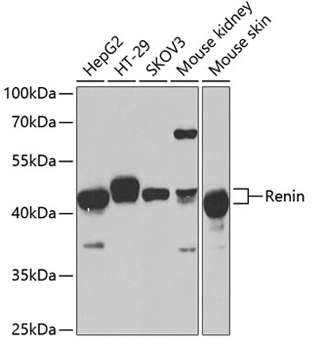 Western blot - Renin antibody (A1585)