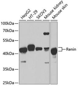 Western blot - Renin antibody (A1585)