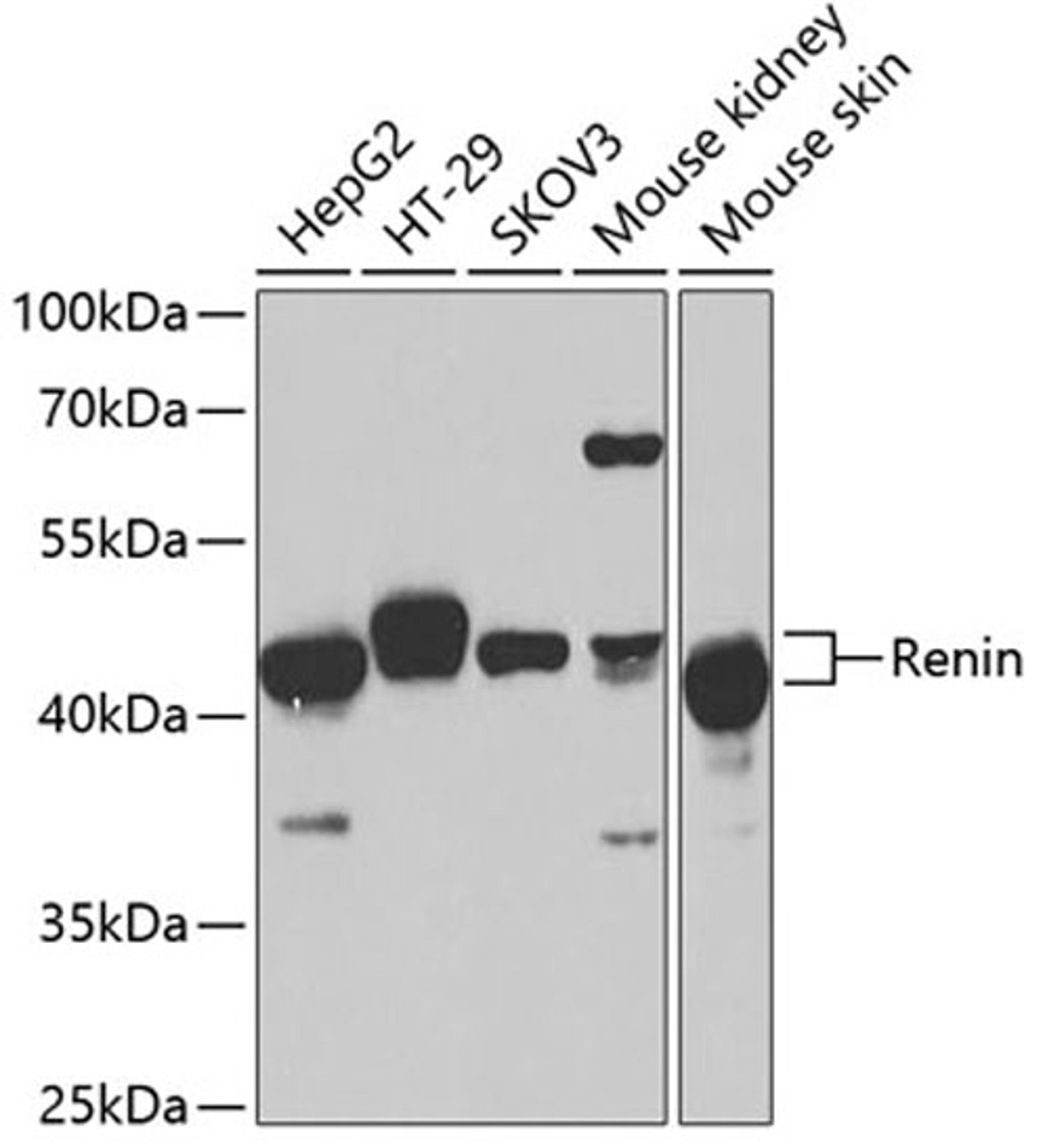 Western blot - Renin antibody (A1585)