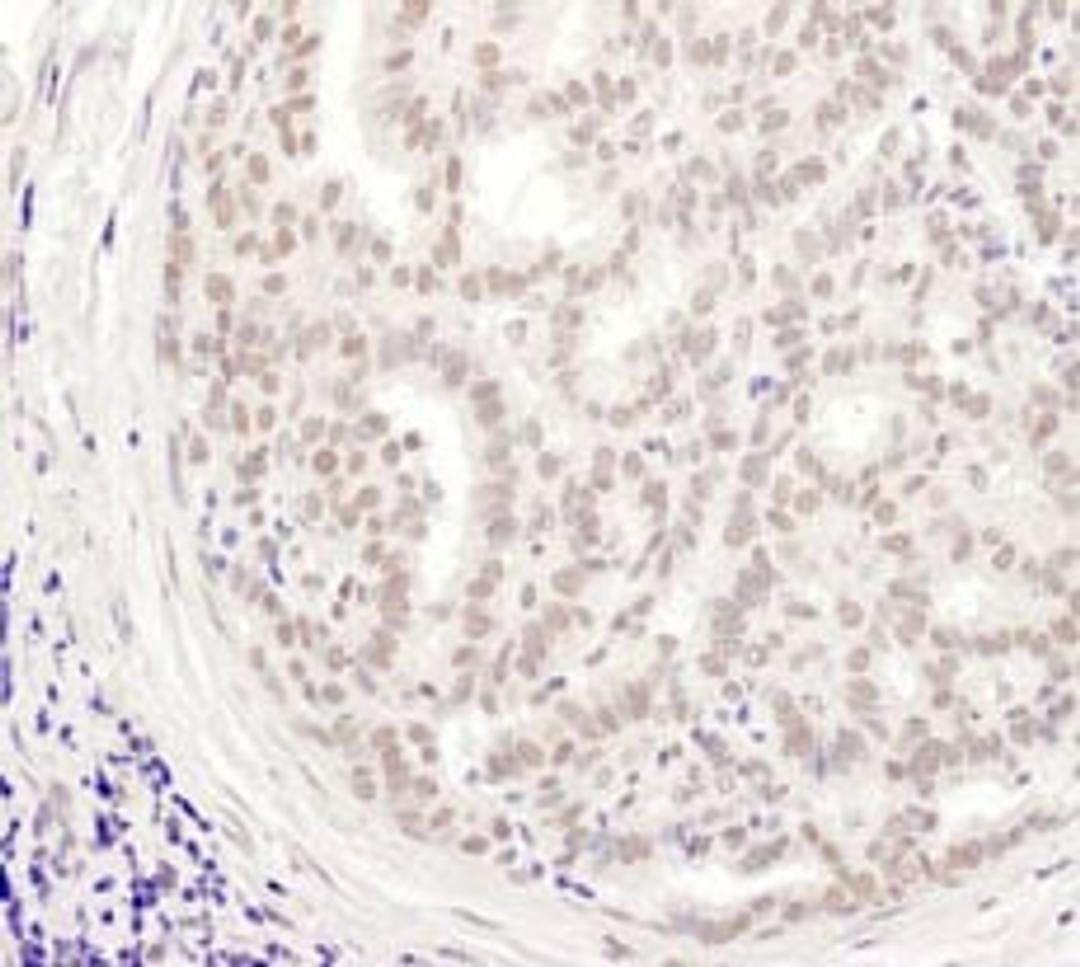 Detection of human MEPCE by immunohistochemistry.