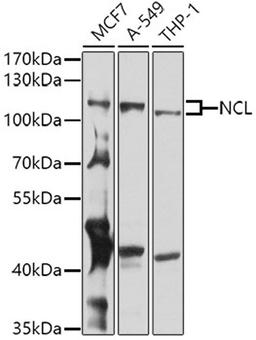 Western blot - NCL antibody (A5904)