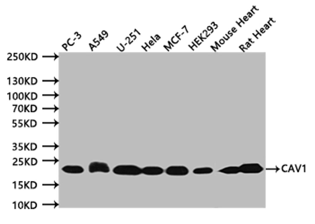 Western BlotPositive WB detected in:PC-3 whole cell lysate (20µg), A549 whole cell lysate (20µg), U251 whole cell lysate (20µg), Hela whole cell lysate (20µg), MCF-7 whole cell lysate (20µg), HEK293 whole cell lysate (20µg), Mouse Heart tissue lysate (20µg), Rat Heart tissue lysate (20µg)All lanes: CAV1 antibody at 1:500SecondaryGoat polyclonal to mouse IgG at 1/50000 dilutionPredicted band size:20 kDaObserved band size:20 kDaExposure time:120s