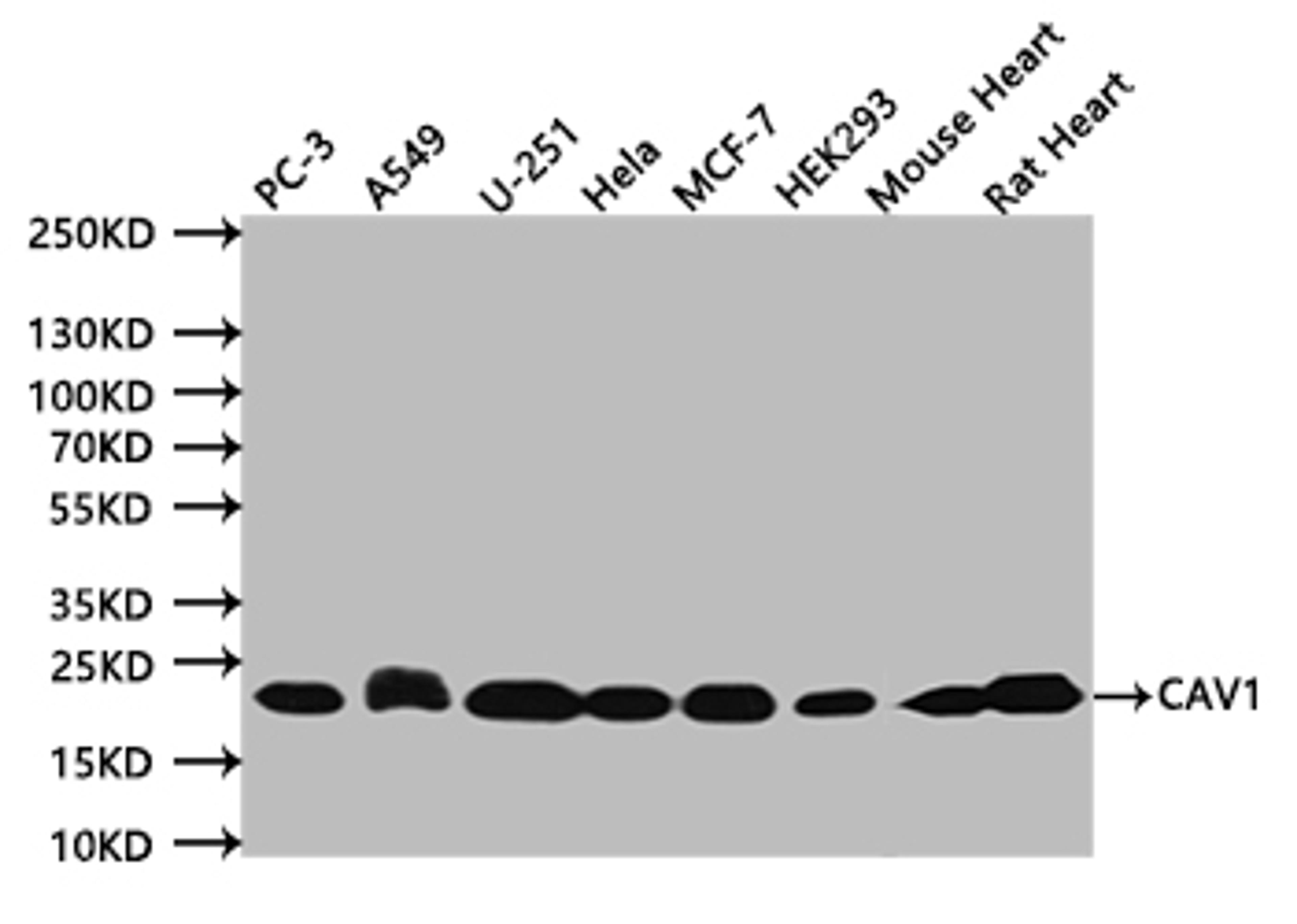Western BlotPositive WB detected in:PC-3 whole cell lysate (20µg), A549 whole cell lysate (20µg), U251 whole cell lysate (20µg), Hela whole cell lysate (20µg), MCF-7 whole cell lysate (20µg), HEK293 whole cell lysate (20µg), Mouse Heart tissue lysate (20µg), Rat Heart tissue lysate (20µg)All lanes: CAV1 antibody at 1:500SecondaryGoat polyclonal to mouse IgG at 1/50000 dilutionPredicted band size:20 kDaObserved band size:20 kDaExposure time:120s