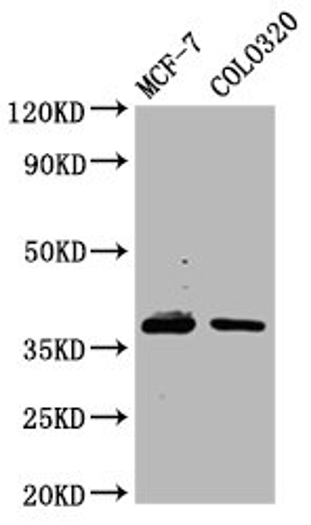 Western Blot. Positive WB detected in: MCF-7 whole cell lysate, Colo320 whole cell lysate. All lanes: PGLYRP3 antibody at 4.86µg/ml. Secondary. Goat polyclonal to rabbit IgG at 1/50000 dilution. Predicted band size: 38 kDa. Observed band size: 38 kDa