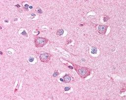 Immunohistochemistry: DISC1 Antibody [NB110-40773] - Staining of DISC1 in human brain neurons and neuropil at 2.5ug/ml. 40X.