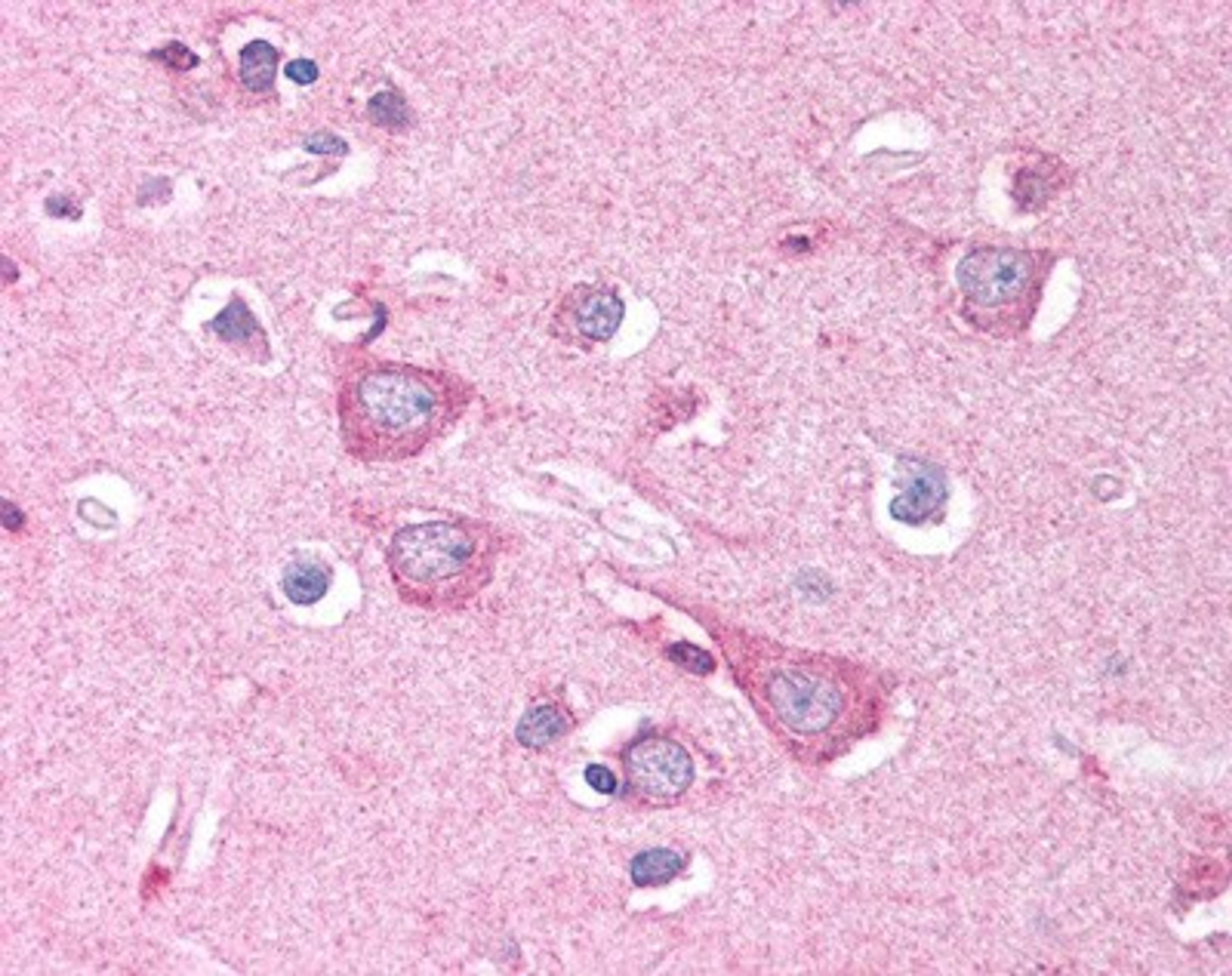 Immunohistochemistry: DISC1 Antibody [NB110-40773] - Staining of DISC1 in human brain neurons and neuropil at 2.5ug/ml. 40X.