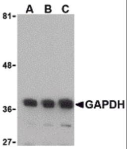 Western blot analysis of GAPDH in HeLa cell lysate with GAPDH antibody at (A) 0.125, (B) 0.25 and (C) 0.5 μg/mL.