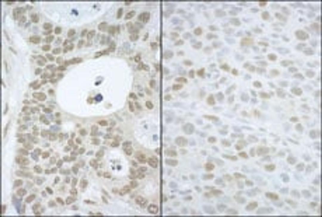 Detection of human and mouse CAND1 by immunohistochemistry.