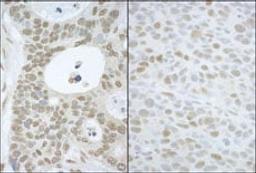 Detection of human and mouse CAND1 by immunohistochemistry.