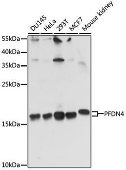 Western blot - PFDN4 antibody (A15300)