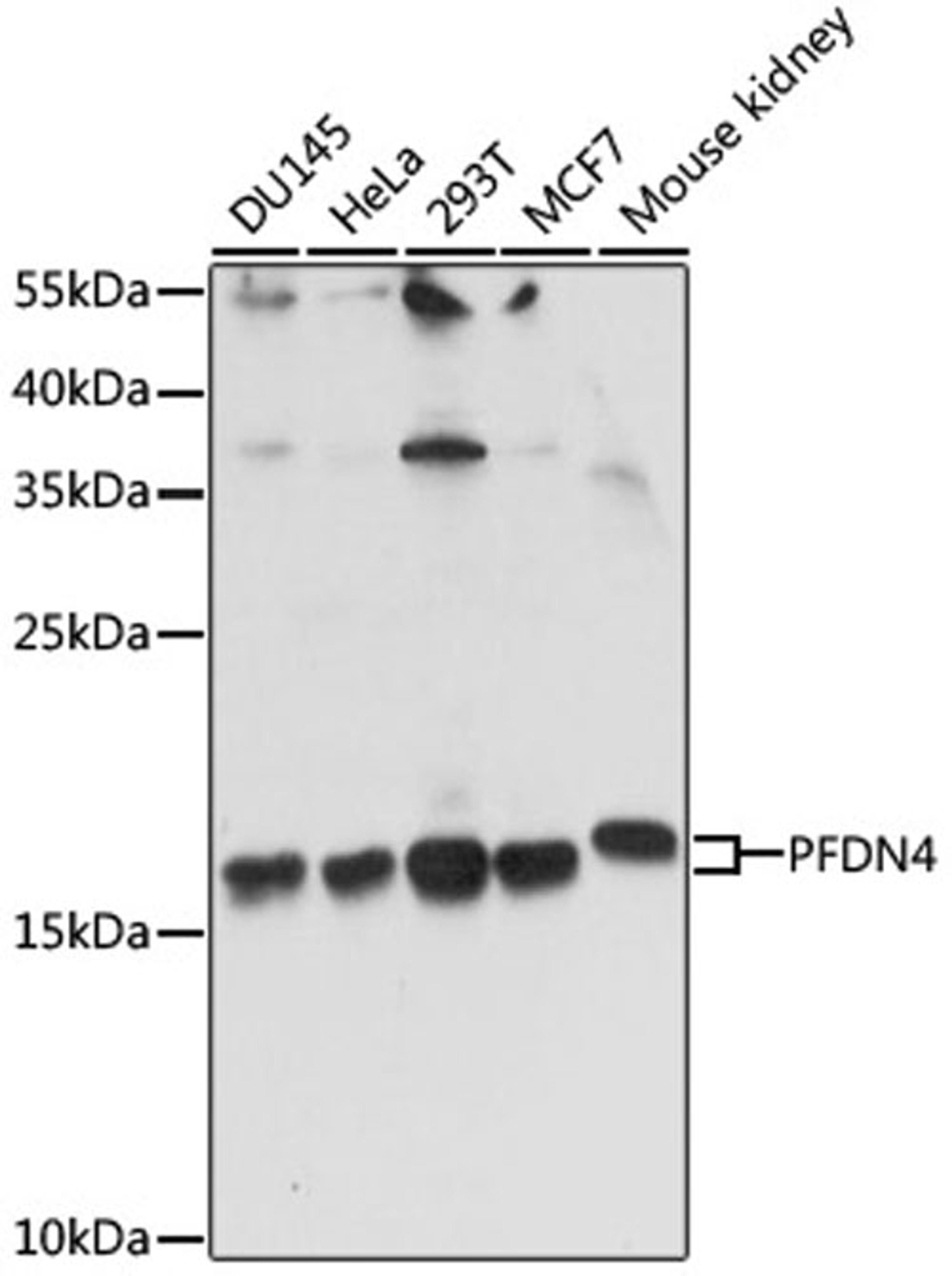 Western blot - PFDN4 antibody (A15300)