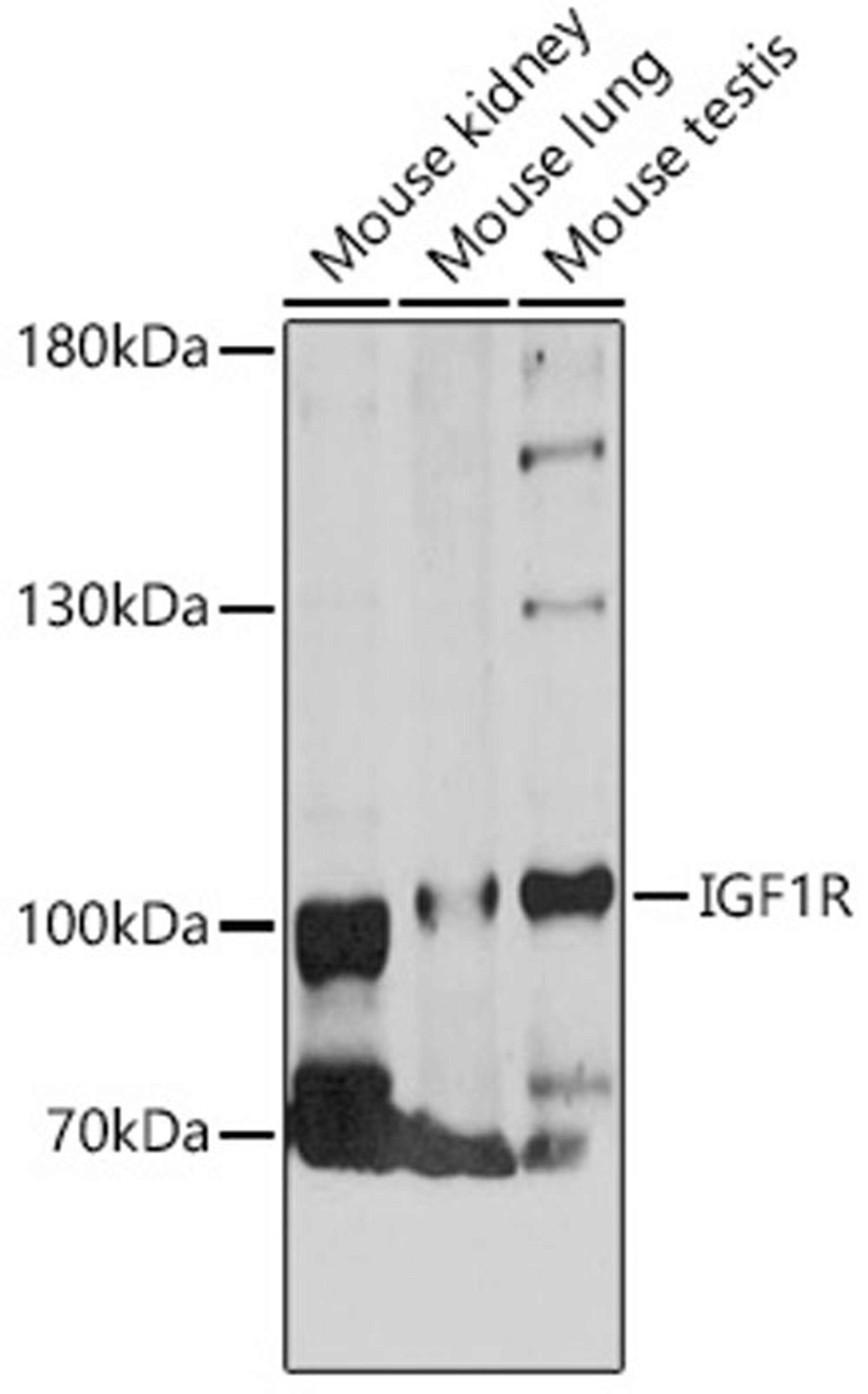 Western blot - IGF1R antibody (A12736)