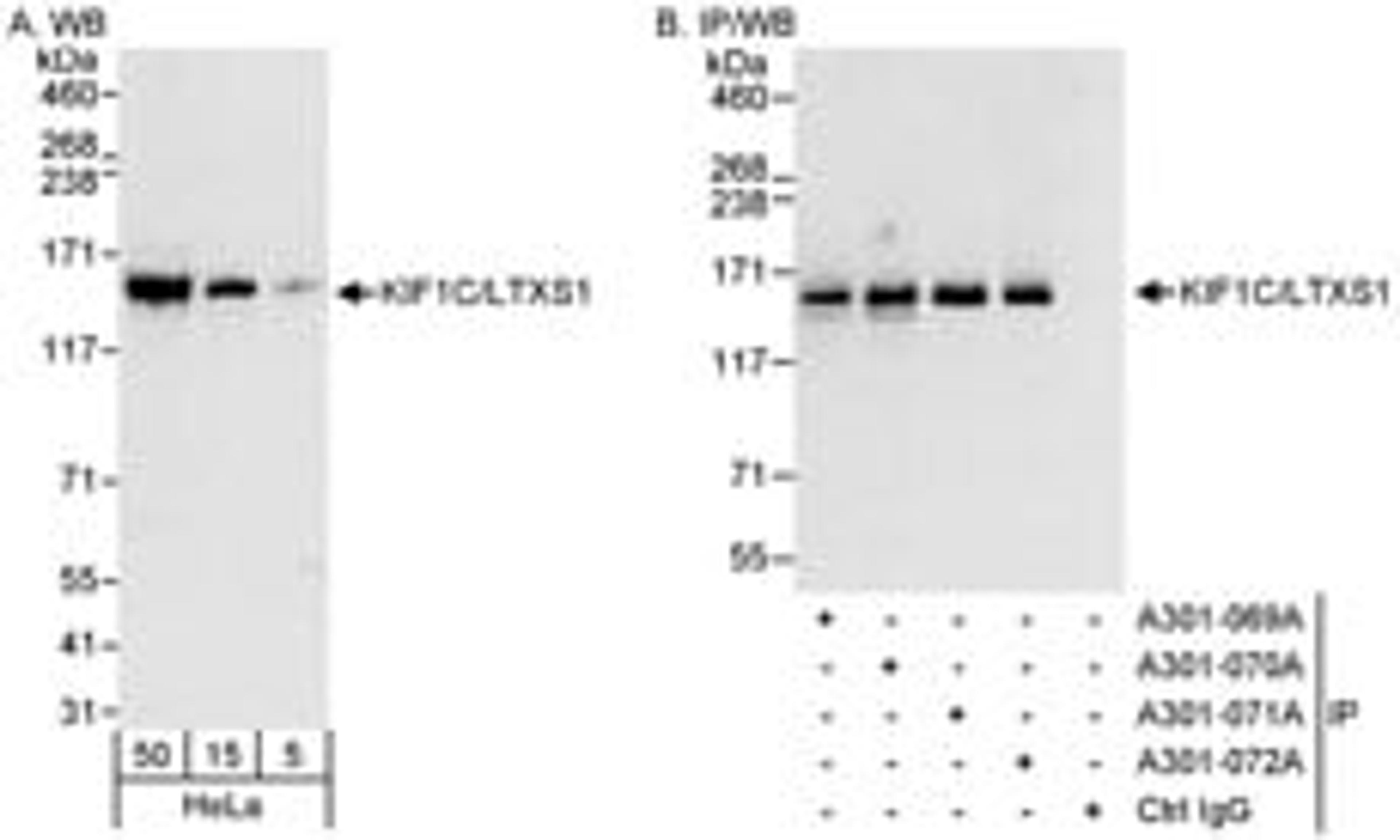 Detection of human KIF1C/LTXS1 by western blot and immunoprecipitation.