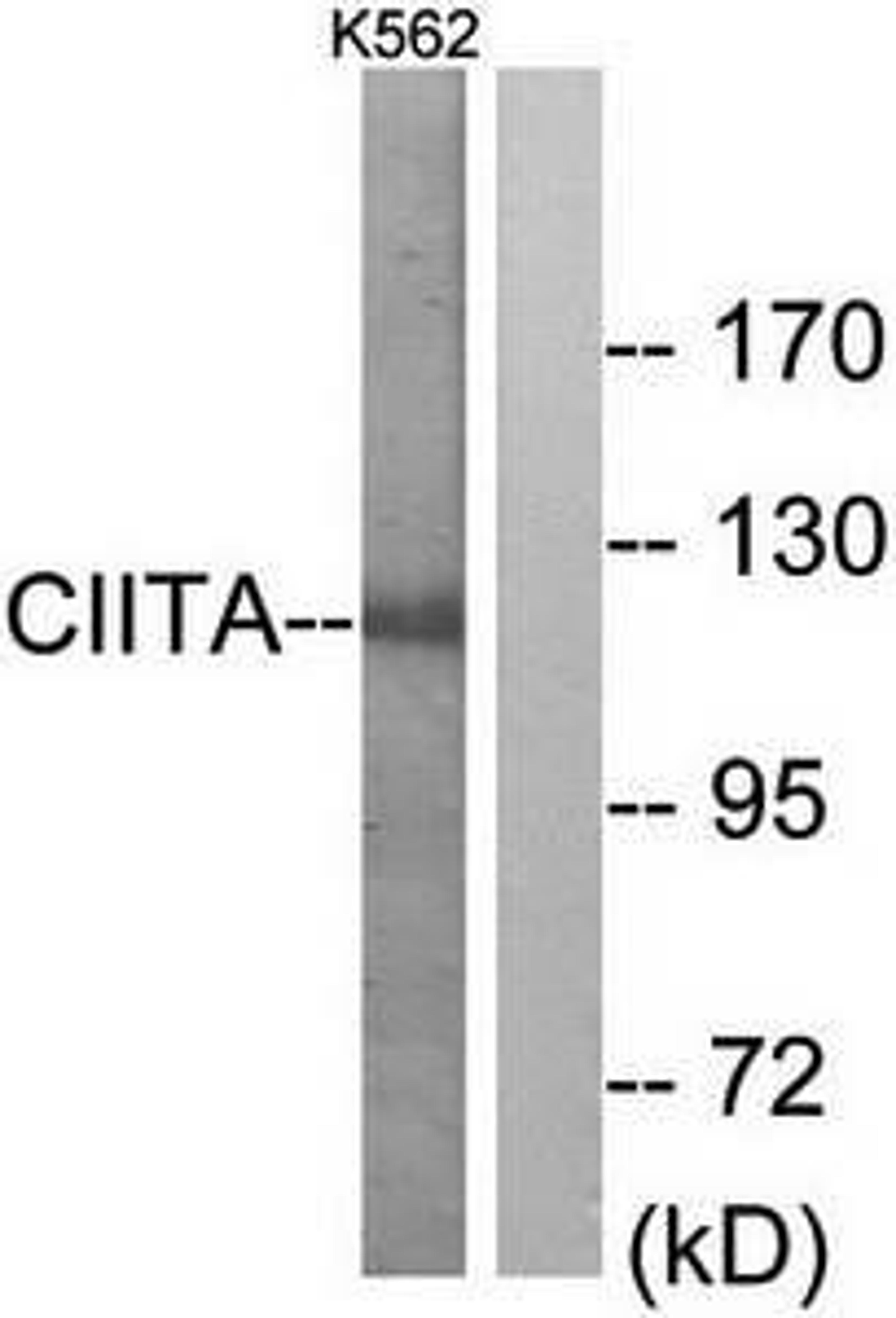 Western blot analysis of extracts from K562 cells using CIITA antibody