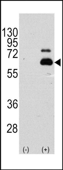 Western blot analysis of RPS6KB1 using rabbit polyclonal RPS6KB1 Antibody (S404) using 293 cell lysates (2 ug/lane) either nontransfected (Lane 1) or transiently transfected with the RPS6KB1 gene (Lane 2).