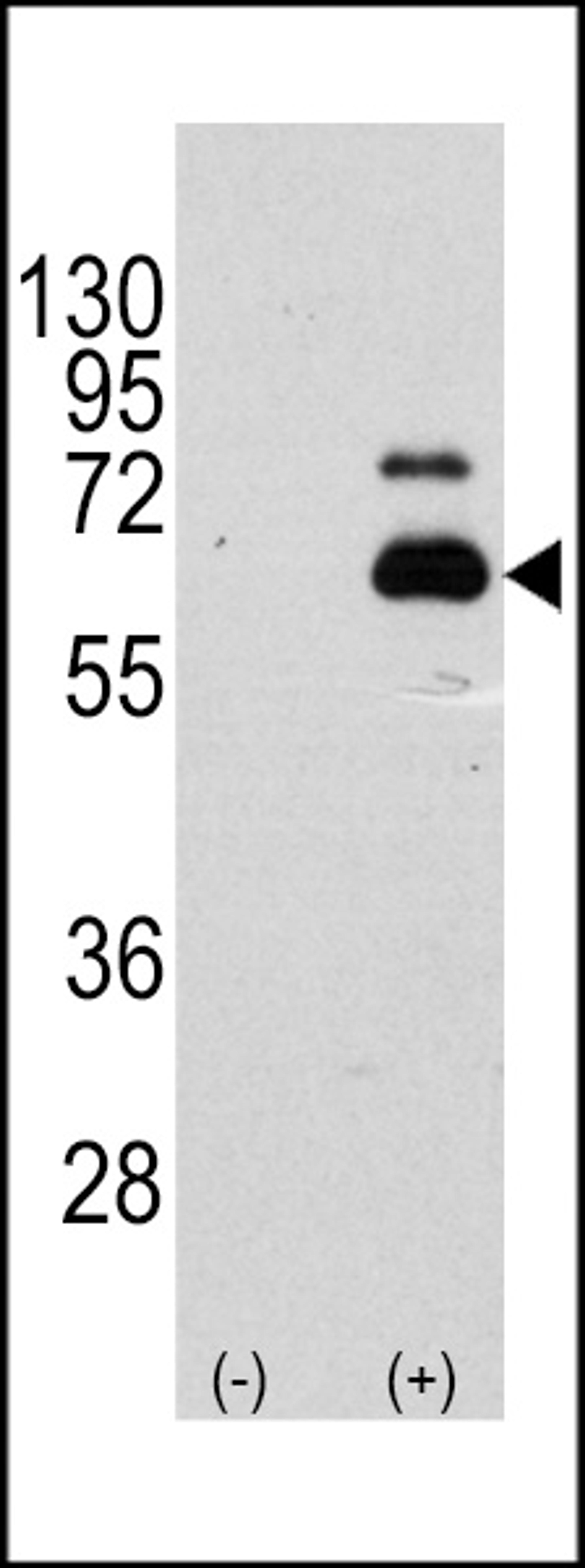 Western blot analysis of RPS6KB1 using rabbit polyclonal RPS6KB1 Antibody (S404) using 293 cell lysates (2 ug/lane) either nontransfected (Lane 1) or transiently transfected with the RPS6KB1 gene (Lane 2).