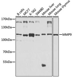 Western blot - MMP9 antibody (A2095)