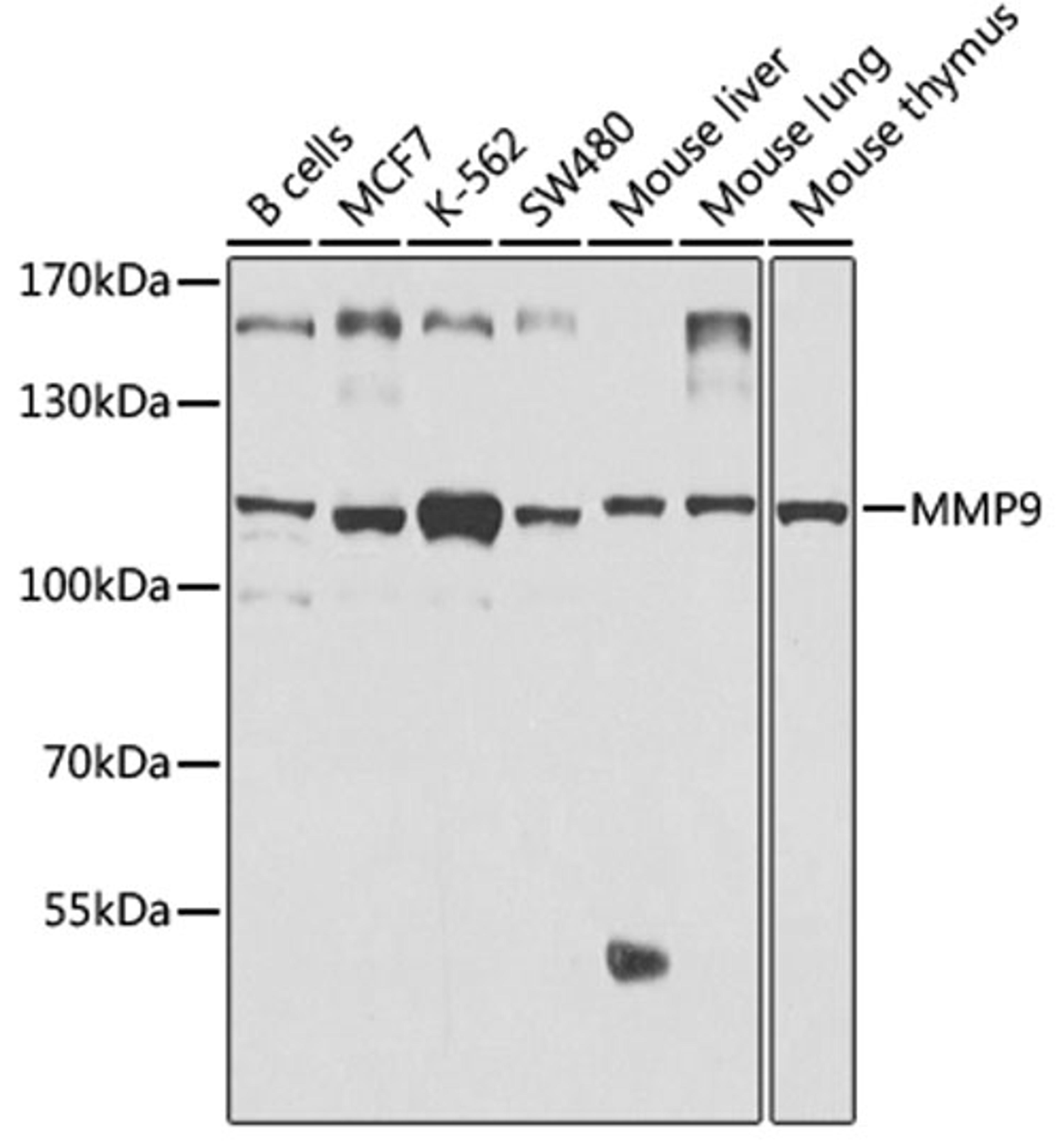 Western blot - MMP9 antibody (A2095)