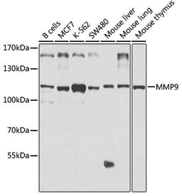 Western blot - MMP9 antibody (A2095)