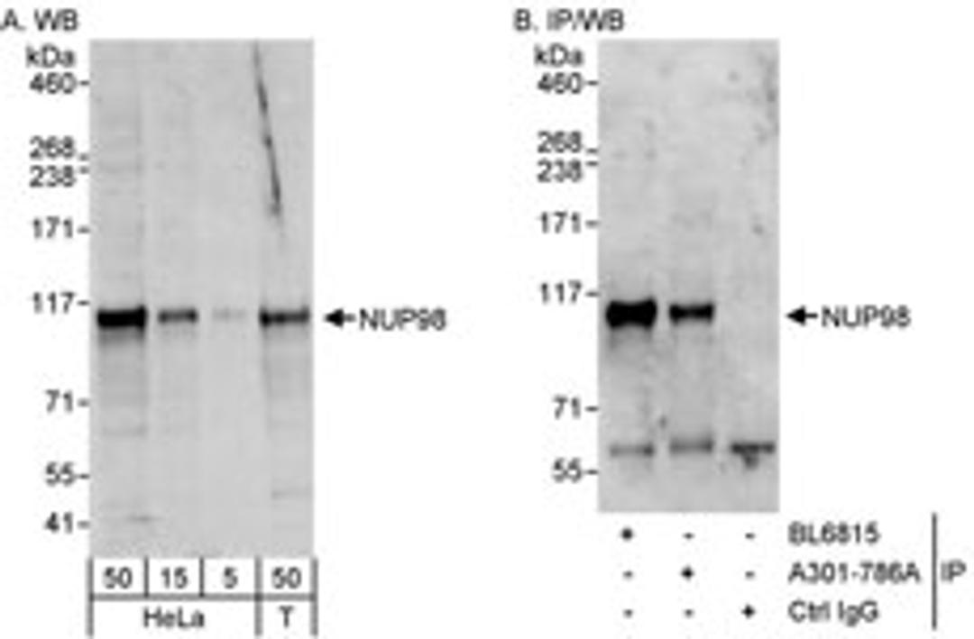 Detection of human NUP98 by western blot and immunoprecipitation.