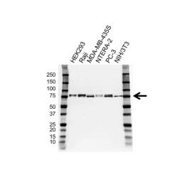 Western blot analysis of whole cell lysates probed with CD271 antibody