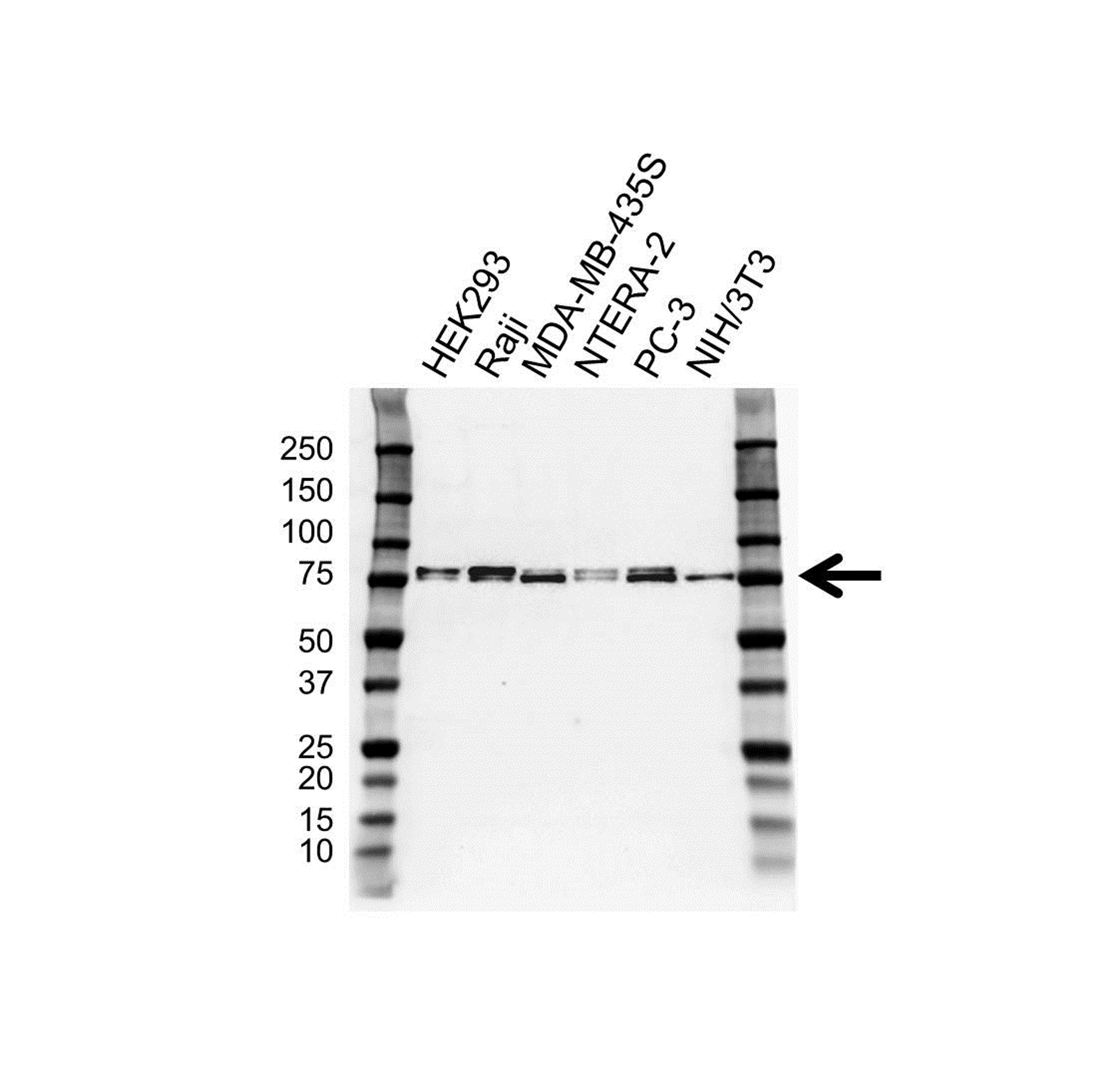 Western blot analysis of whole cell lysates probed with CD271 antibody