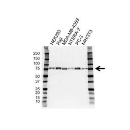 Western blot analysis of whole cell lysates probed with CD271 antibody