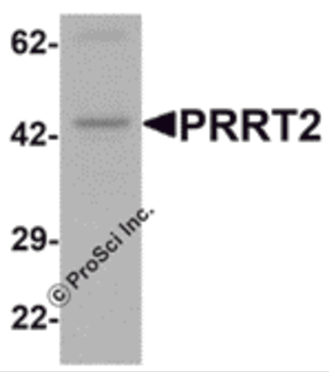 Western blot analysis of PRRT2 in mouse brain tissue lysate with PRRT2 antibody at 1 μg/mL.