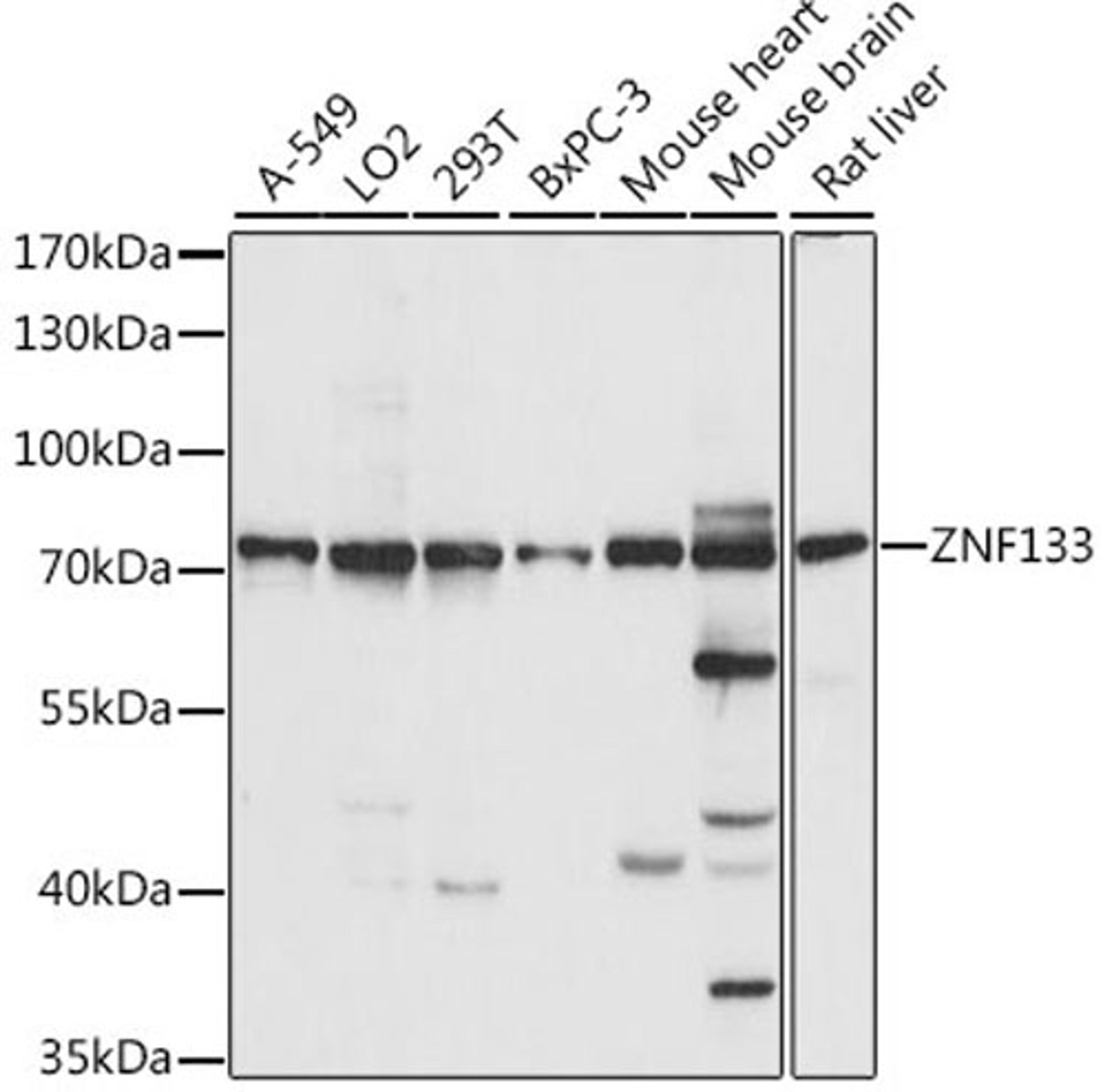 Western blot - ZNF133 antibody (A15738)